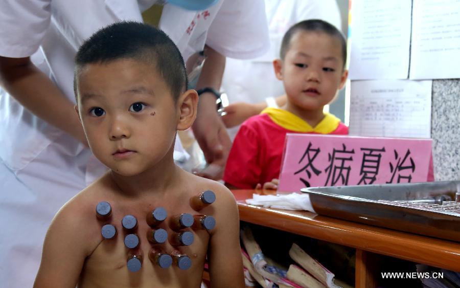 Sanfu Paste: Traditional Chinese medicine treatment in summer