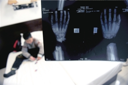 九齡童被養(yǎng)母砍斷手扔茅坑 進(jìn)京求醫(yī)盼激活手腕