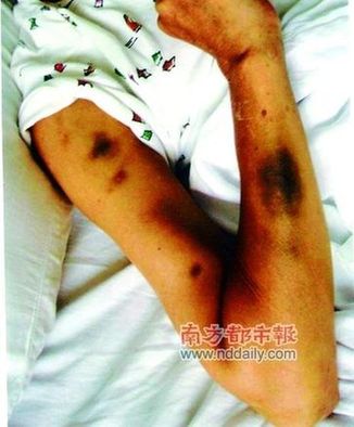 湖北廳官妻子遭警察圍毆16分鐘 公安稱打錯(cuò)了