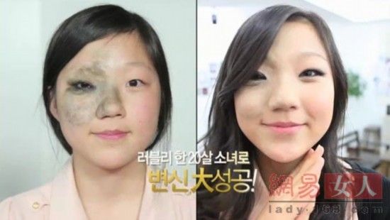 丑女變靚妹！韓國(guó)整容節(jié)目爆紅