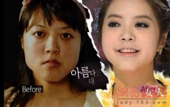 丑女變靚妹！韓國整容節(jié)目爆紅