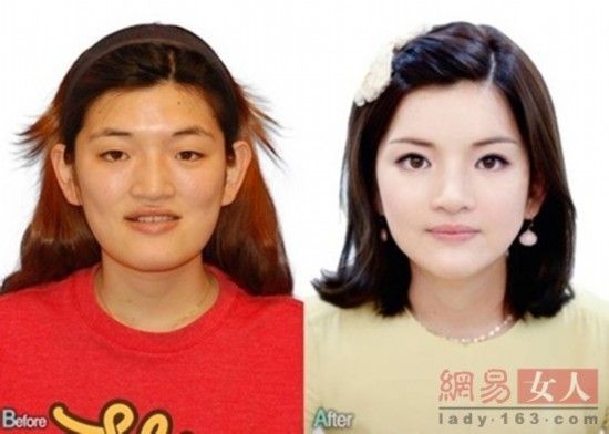 丑女變靚妹！韓國(guó)整容節(jié)目爆紅