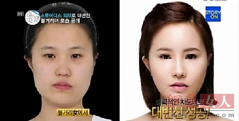 丑女變靚妹！韓國整容節(jié)目爆紅