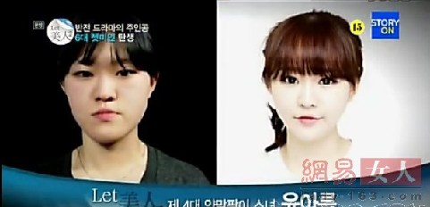 丑女變靚妹！韓國(guó)整容節(jié)目爆紅