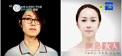 丑女變靚妹！韓國(guó)整容節(jié)目爆紅