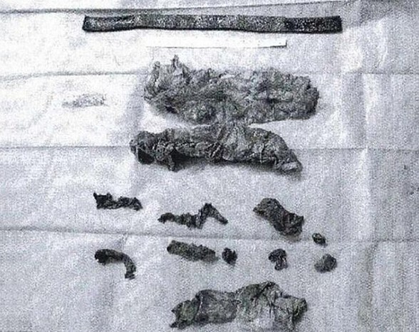 德國(guó)粗心醫(yī)生在患者體內(nèi)留下16件異物 家屬提出巨額索賠