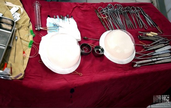 探秘國(guó)外令人觸目驚心的廉價(jià)整容