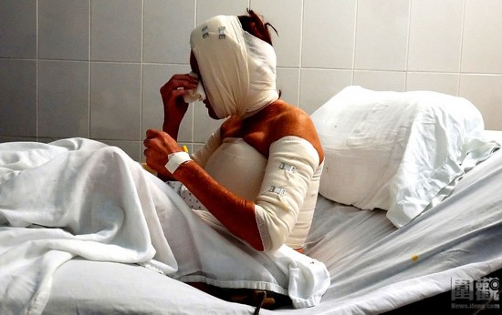 探秘國外令人觸目驚心的廉價(jià)整容