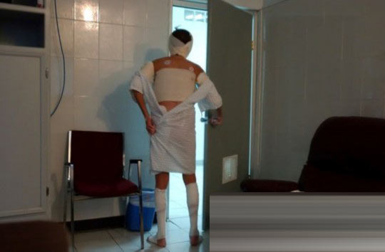 探秘國外令人觸目驚心的廉價整容