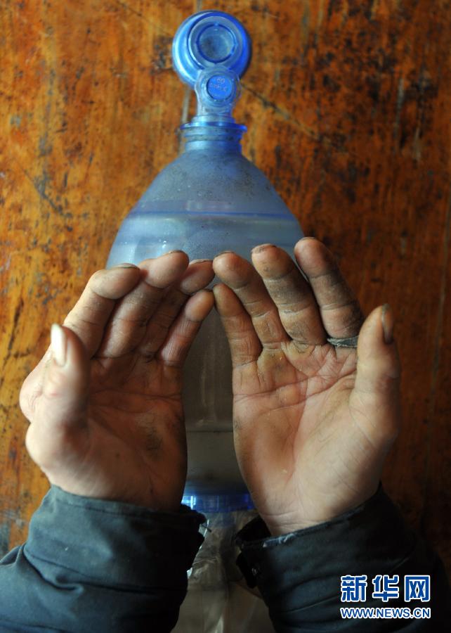 浙江“慈愛雙親”自制呼吸機(jī)為兒續(xù)命