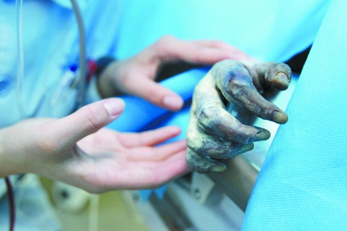 鄧州女孩火海救母引全國(guó)愛(ài)心爆發(fā) 母親欲割皮救女