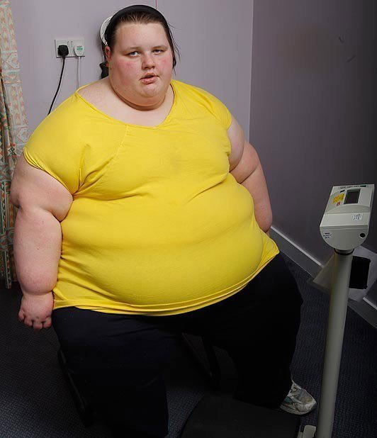 盤點(diǎn)全球令人無(wú)法想象的胖人