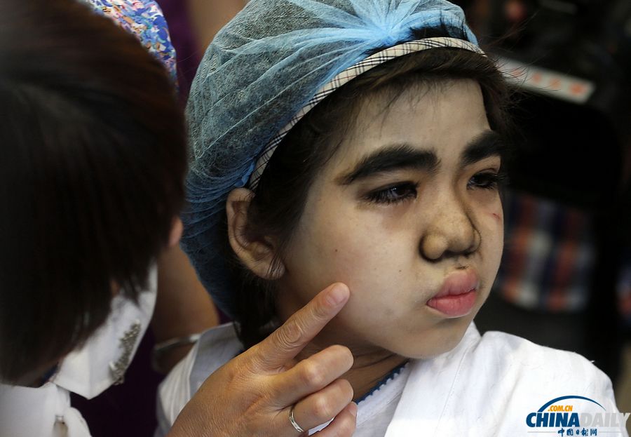 杭州:10歲輟學(xué)“毛孩”受關(guān)愛(ài) 接受面部激光脫毛