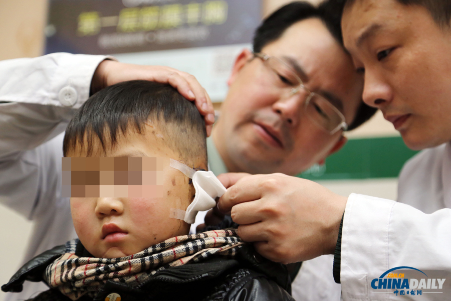 6歲男童慘遭嬸嬸割耳續(xù):有醫(yī)院免費為他造左耳