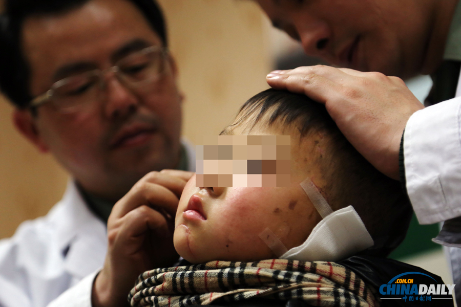 6歲男童慘遭嬸嬸割耳續(xù)：有醫(yī)院免費(fèi)為他造左耳