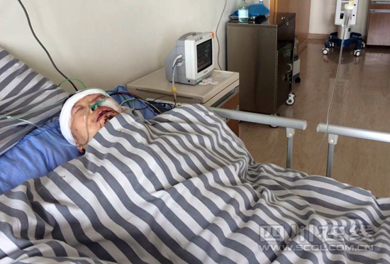 成都一30歲男子因語言沖突將父親砍傷 母親報警(圖)