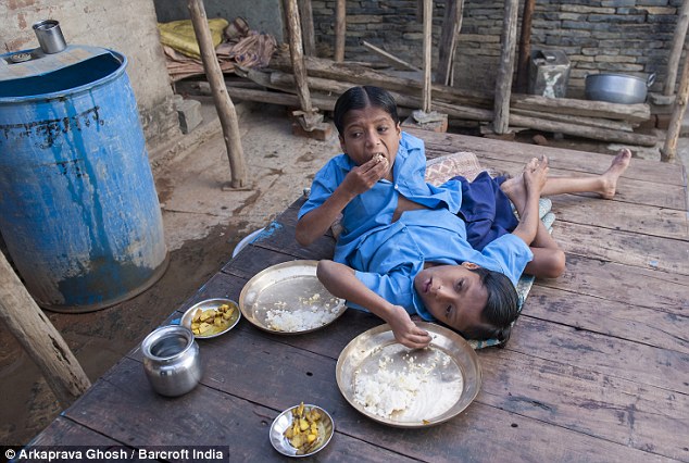 印度連體兄弟被奉為神靈 坦言不想被分離