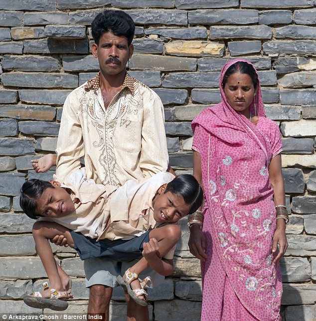 印度連體兄弟被奉為神靈 坦言不想被分離