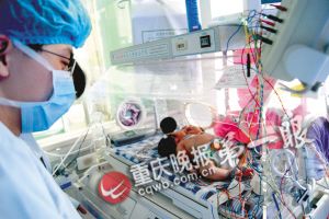 重慶22專家會診雙頭女嬰認(rèn)定屬單體 仍未脫離危險(xiǎn)