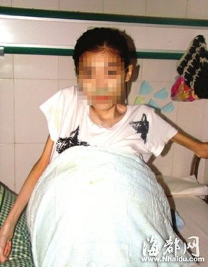 龍巖女孩患怪病肚子大過(guò)孕婦 微博接力傳愛(ài)心(圖)