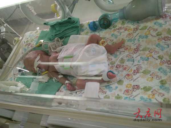 大慶龍鳳胎母親求援:治療費(fèi)用還差20萬 有借必有還(圖)