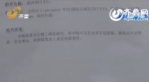 菏澤男孩鼻腔手術(shù)后藏20厘米長紗布 7個月后才發(fā)現(xiàn)