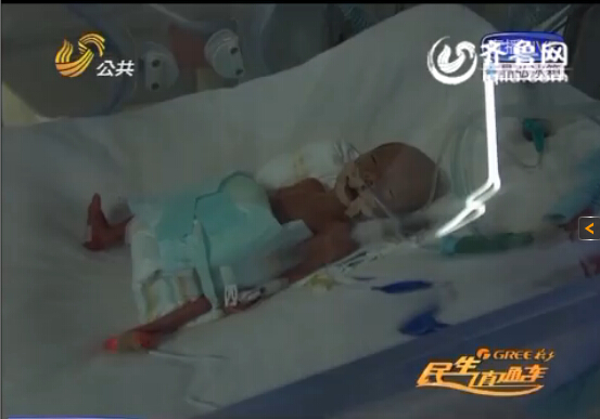 菏澤四胞胎治療花費(fèi)已超20萬(wàn) 一女一男出現(xiàn)感染