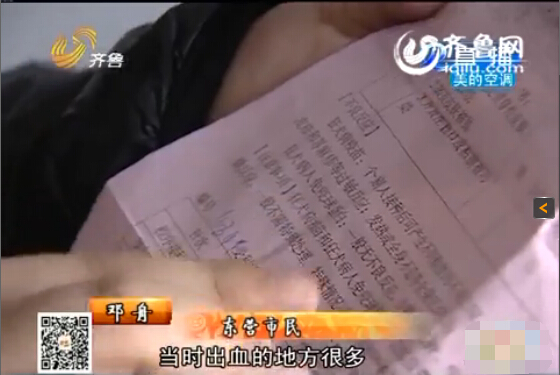 東營:男子與同事辦公室打架被咬臉 對方拒絕賠償