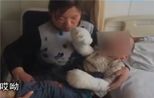 聊城兩歲半男孩雙手浸入油鍋 燙傷嚴(yán)重疼痛難耐