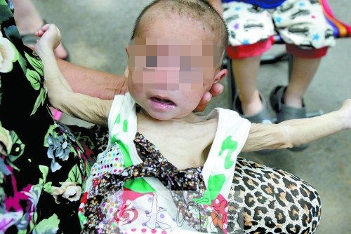 “饑餓娃娃”共兄妹四個(gè) 其父堅(jiān)稱不要這個(gè)女孩(圖)