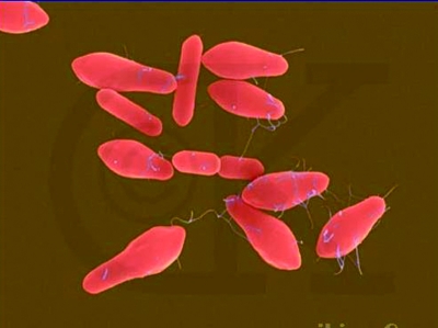 原料里查出肉毒桿菌 新西蘭38噸“毒奶粉”恐流入中國(guó)