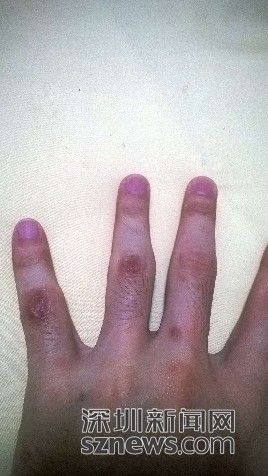 男子街頭遭兩名便衣警察毆打后被告知抓錯(cuò)人