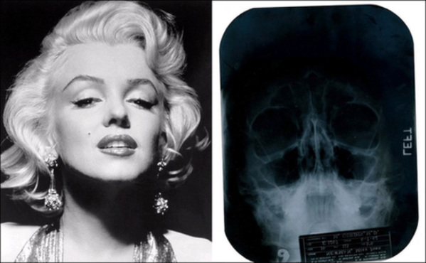 瑪麗蓮夢露被曝曾整容 X光照片將拍賣