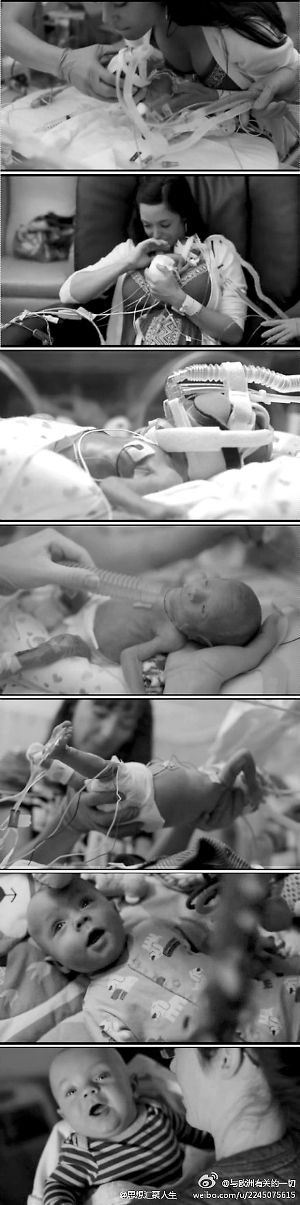 “你就是生命的奇跡！” 早產(chǎn)寶寶堅(jiān)強(qiáng)活下來