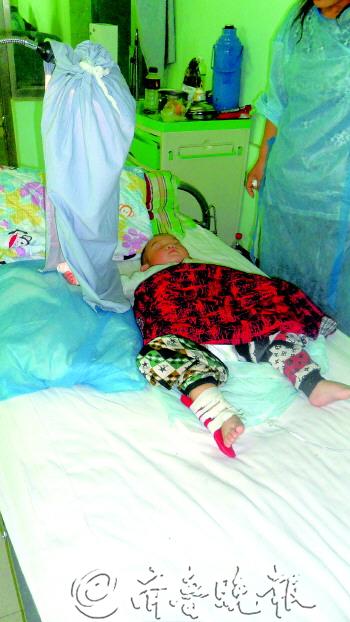 一歲娃逗兔子手指險被嚼碎 專家：養(yǎng)寵物要謹慎