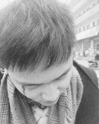 環(huán)保志愿者調(diào)查企業(yè)排污遭打 企業(yè)稱曾被人敲詐