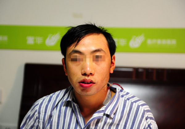重慶“歪臉”小伙深圳獲資助 手術(shù)助其恢復(fù)正常容貌