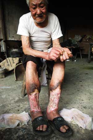 Survivors of Japanese germ war in Jinhua