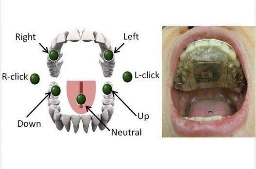 殘疾人可用舌頭操控輪椅！美研發(fā)易于操作驅(qū)動系統(tǒng)