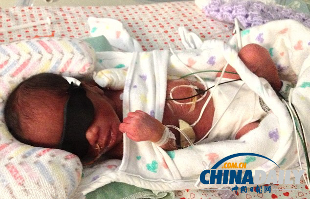 美夫婦生下雙胞胎后又迎來(lái)五胞胎