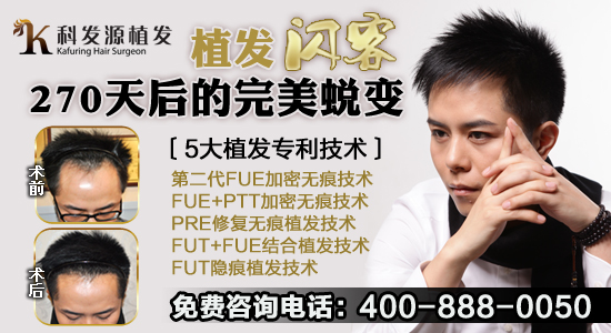 脫發(fā)的原因有哪些?科發(fā)源揭秘脫發(fā)三大原因