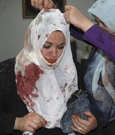 伊拉克再發(fā)自殺襲擊 至少造成185人傷亡