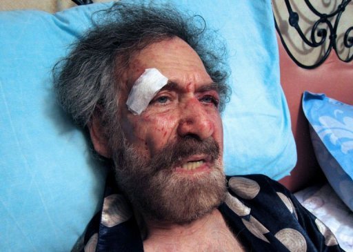 因諷刺政府和總統(tǒng) 敘利亞著名漫畫家遭蒙面人毒打