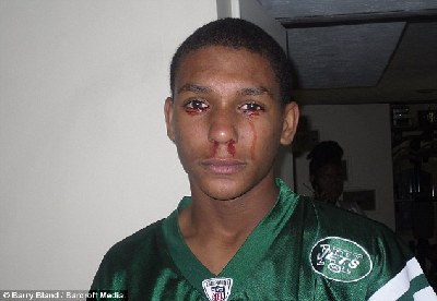 “他們說我魔鬼附身” 美國少年流“血淚”醫(yī)生無解