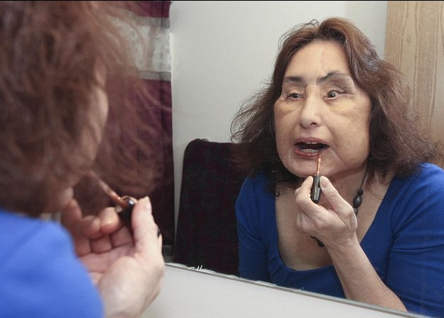 美國(guó)“換臉女”的人生奮斗 雖與兇手丈夫離婚但愛(ài)心不變