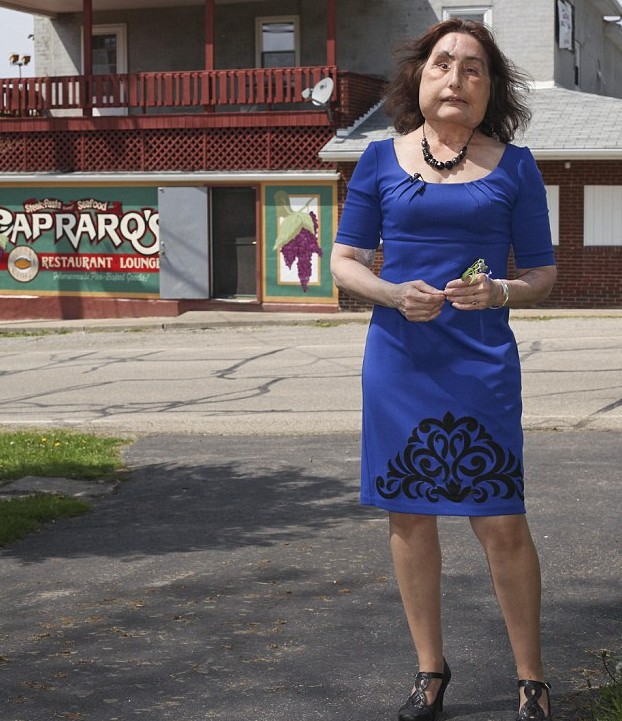 美國(guó)“換臉女”的人生奮斗 雖與兇手丈夫離婚但愛(ài)心不變