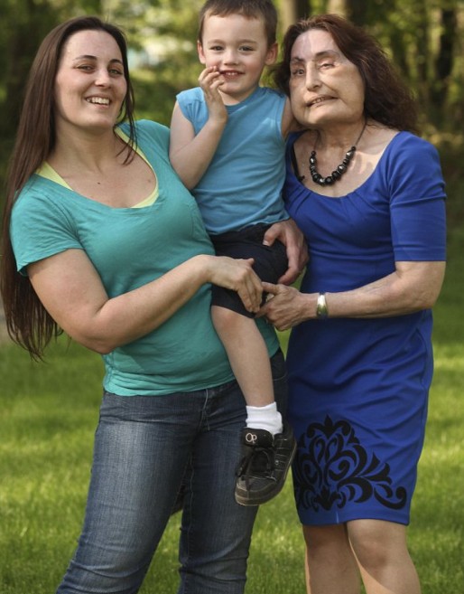 美國(guó)“換臉女”的人生奮斗 雖與兇手丈夫離婚但愛(ài)心不變