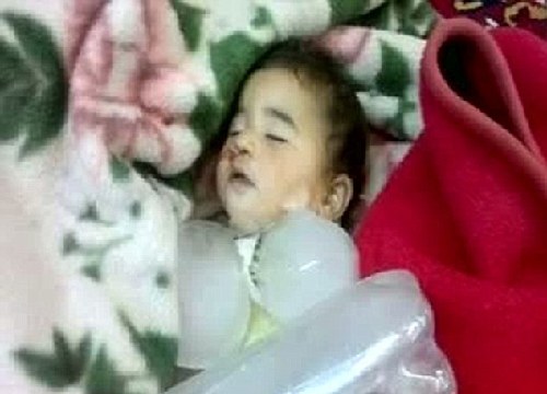 敘利亞哈馬省慘案幸存者回憶可怕細(xì)節(jié) 聯(lián)合國監(jiān)督團(tuán)遭襲未能進(jìn)入現(xiàn)場勘察