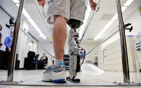 美國男子用意念控制仿生假肢 欲挑戰(zhàn)103層大廈