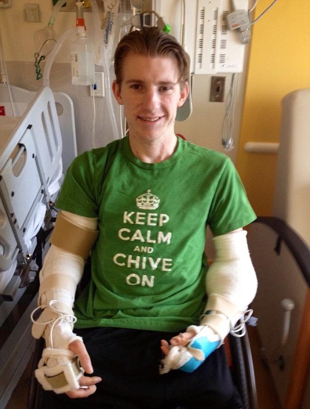 美大兵成功接受雙臂移植手術(shù) 失去四肢頑強(qiáng)生存事跡鼓舞眾人